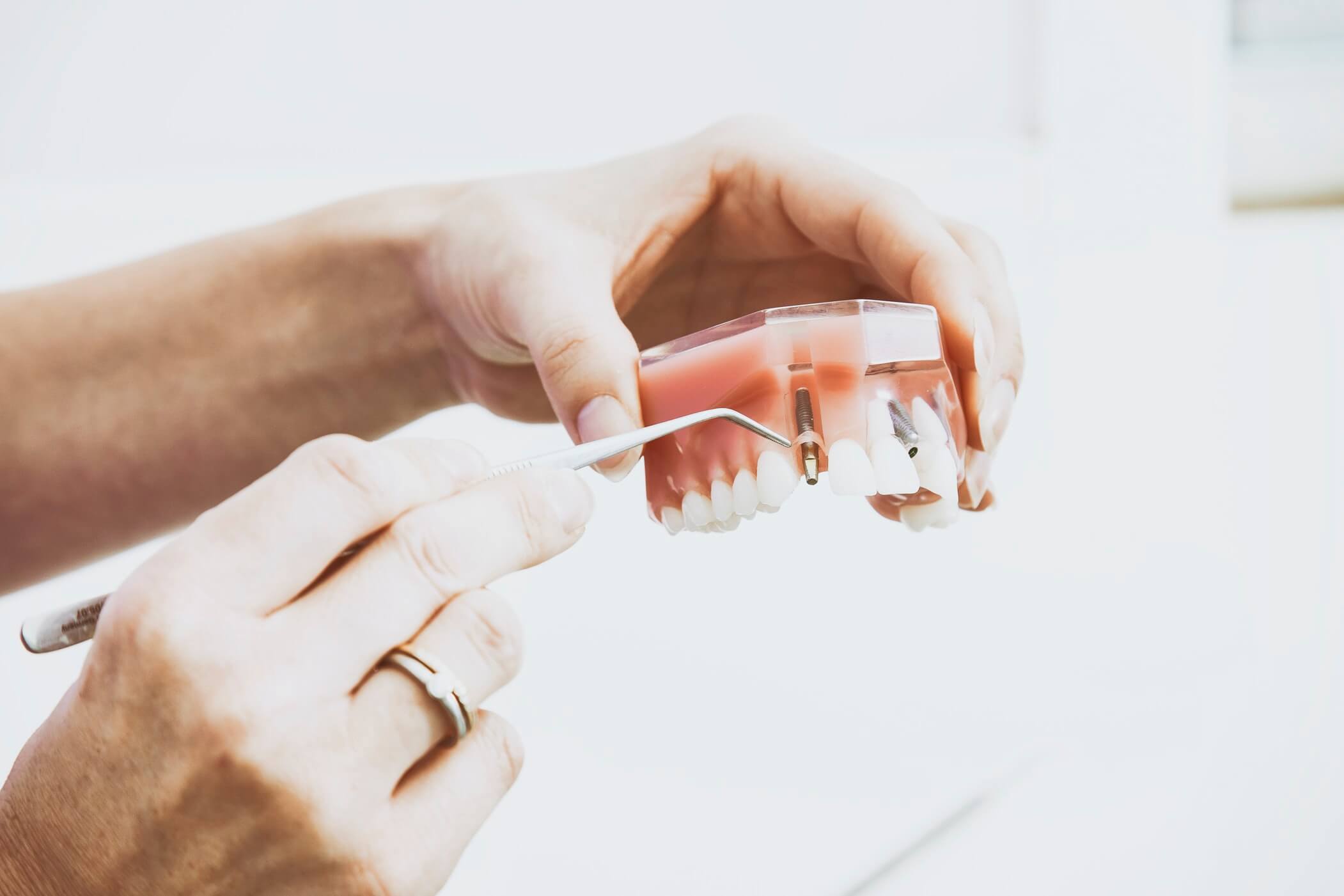 dental implants lincoln